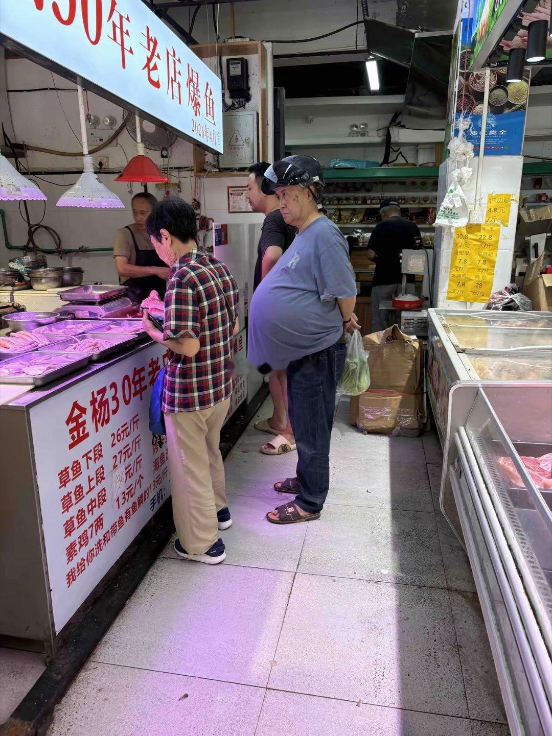 肚子这么大是正常的吗