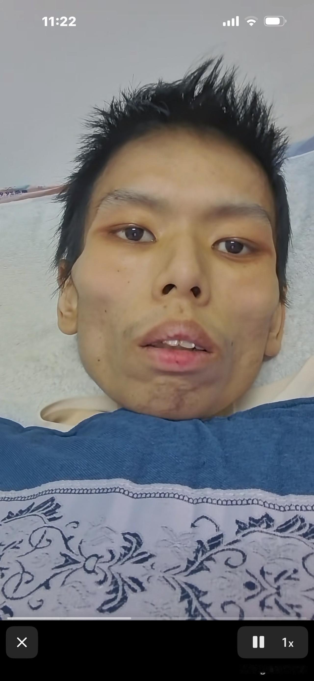 “我不行了，现在胸闷气短，有濒死感，不管有钱没钱，我都要去医院！”这是一位2