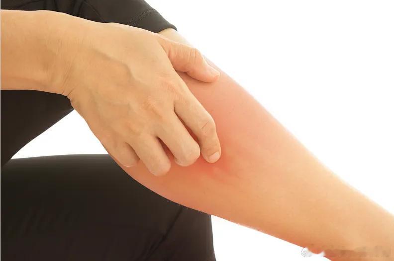 腿上掉皮屑是皮肤病吗健闻登顶计划国民医生说腿上掉皮屑不一定是皮肤病，可能由多种