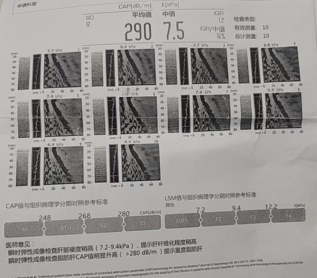 切记！！！坚持锻炼控制饮食的好处，效果真的很明显。跨度100天，其中有90天每天