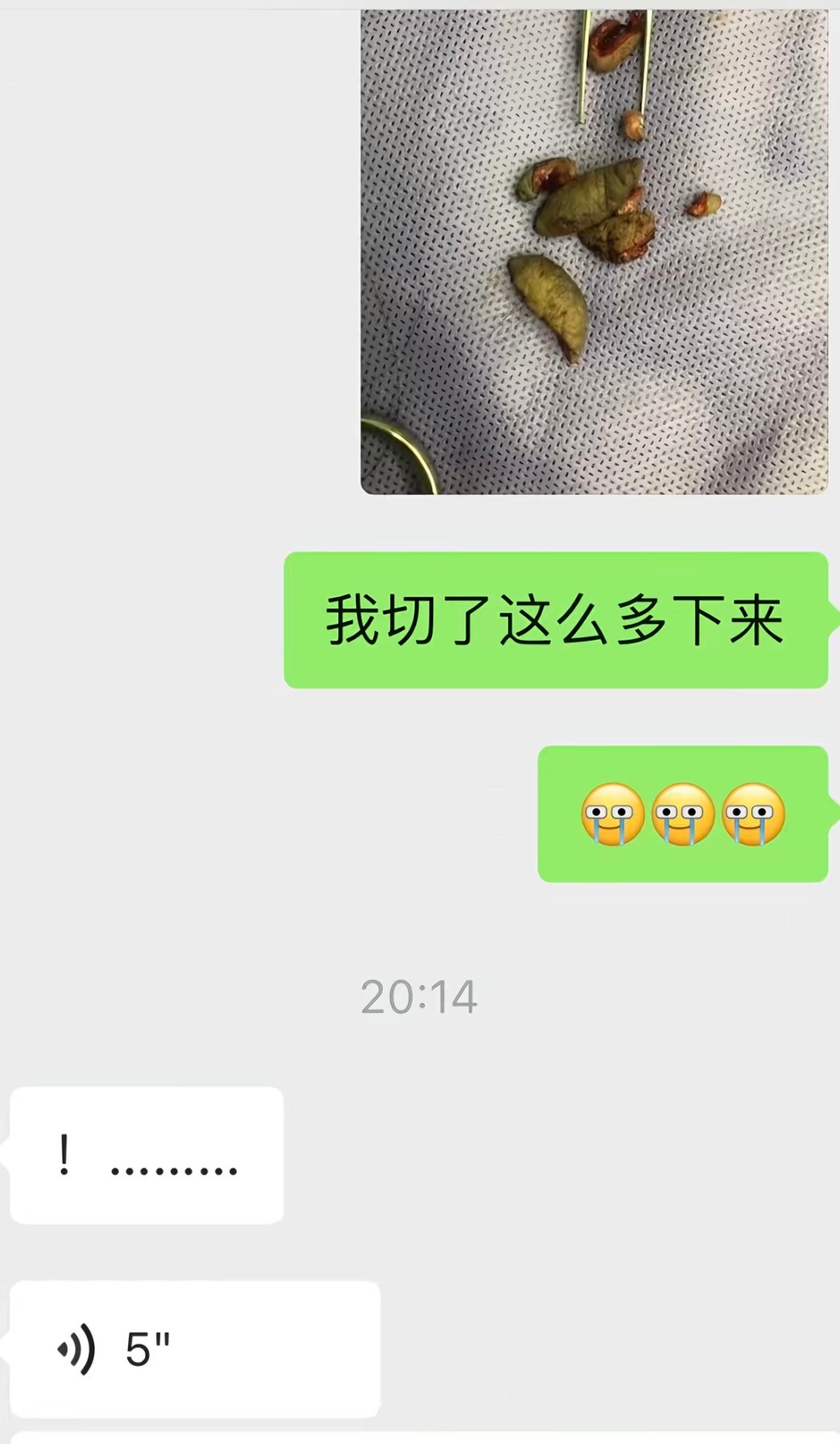 我刷到了一些奇怪的东西一个女生，健身，健美，想打比赛，被人建议服用了类固醇，然后