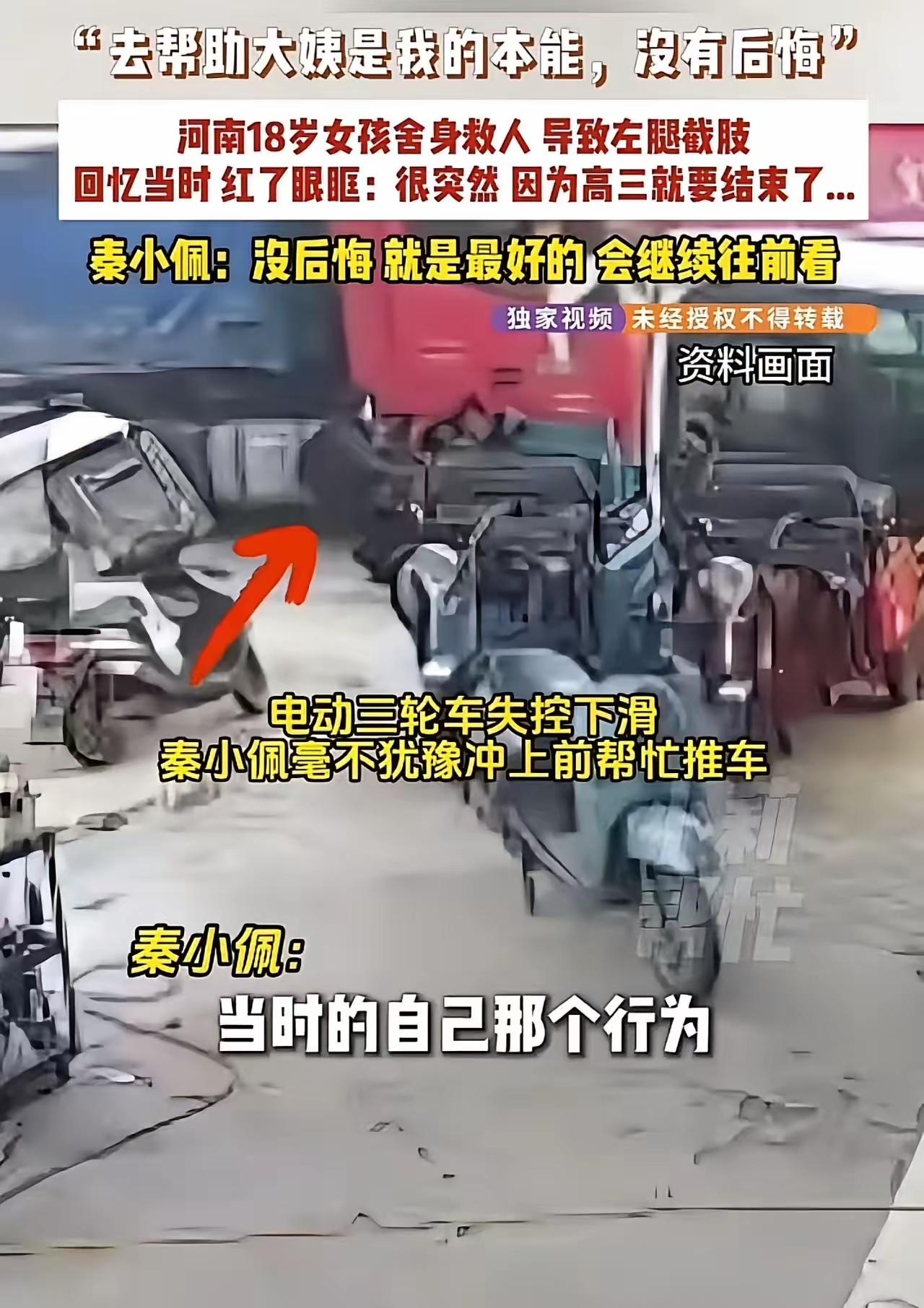 一条腿换一条命，18岁河南女孩的无悔抉择2025年3月7日，河南上蔡县崇礼