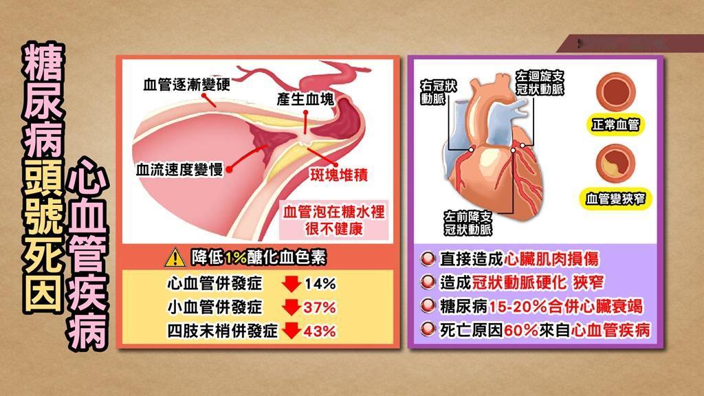 ST段抬高。ST段抬高是急性心肌梗塞的一种表现，代表着心脏上的冠状动脉出现