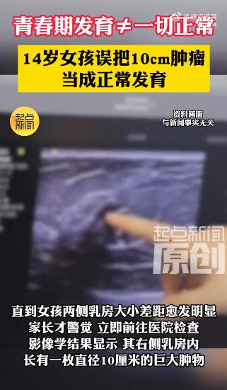 太吓人了！6月16日报道，西安，14岁初二女生洗澡时无意摸到右侧乳房有个硬块，像