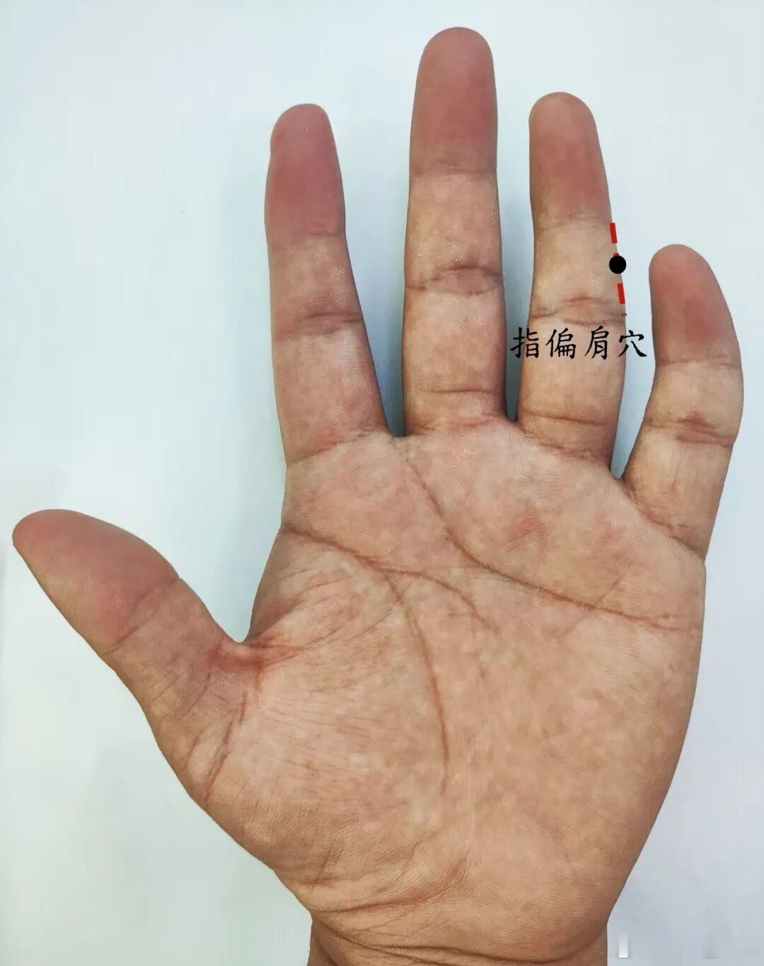落枕奇穴指偏肩穴指偏肩穴源自董氏奇穴位置：在手掌面，无名指第二指节正中央偏尺侧