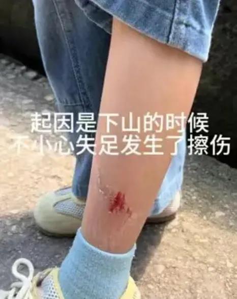 龟峰景区这事，让人心里挺堵得慌！五一假期，一位妈妈带孩子爬山，娃不小心刮伤了