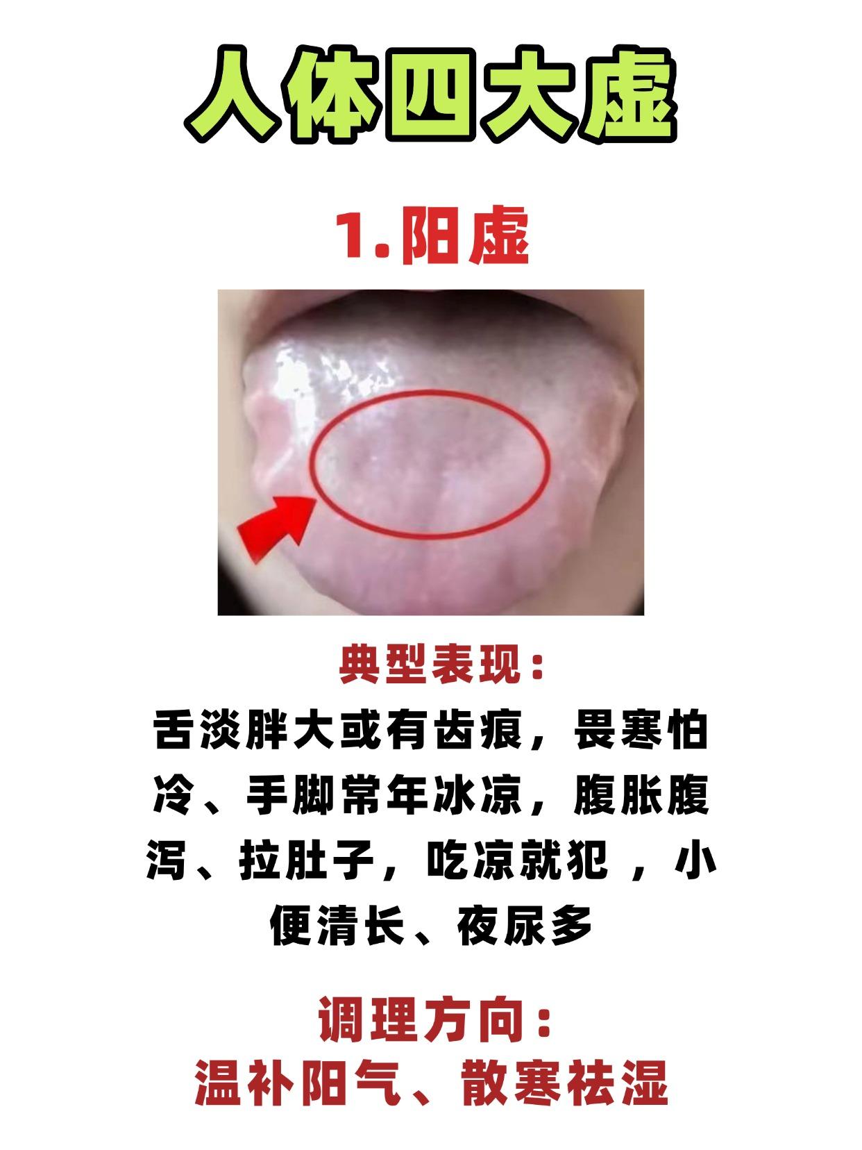 同样是“虚”，为啥有人怕冷有人怕热？原来都是四大虚在“捣乱”！1.阳虚