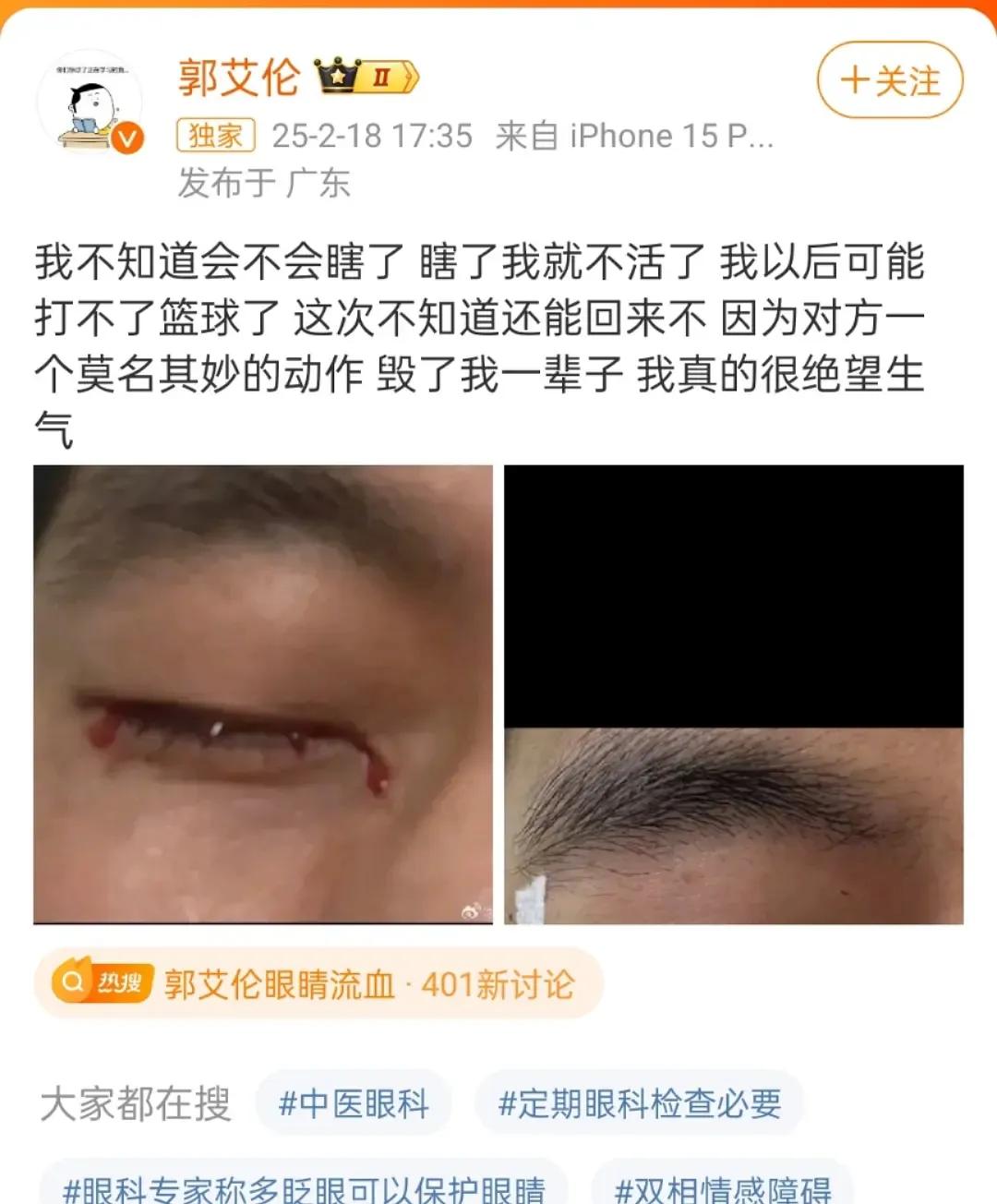 郭艾伦眼睛受伤了[惊恐]被人戳进眼珠里，该多疼啊，太惨了队员也太不小心了