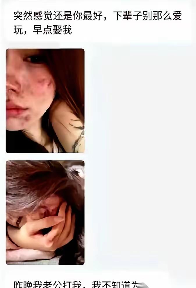 一女子被老公打，哭着拍下受伤的照片，没发给闺蜜，也没发给家人，而是第一时间发给了