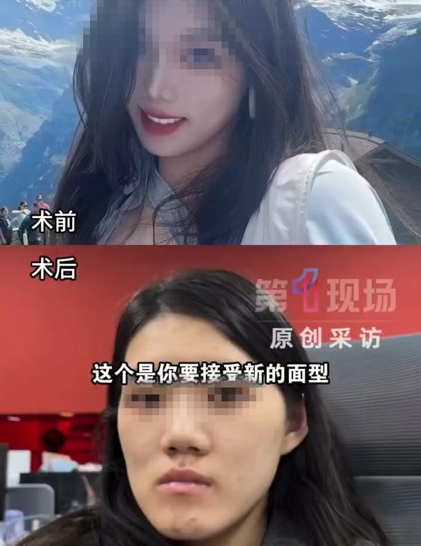 万万没想到！7月27日四川观察报道，湖北武汉，24岁女子满怀期待躺上手术台，打算