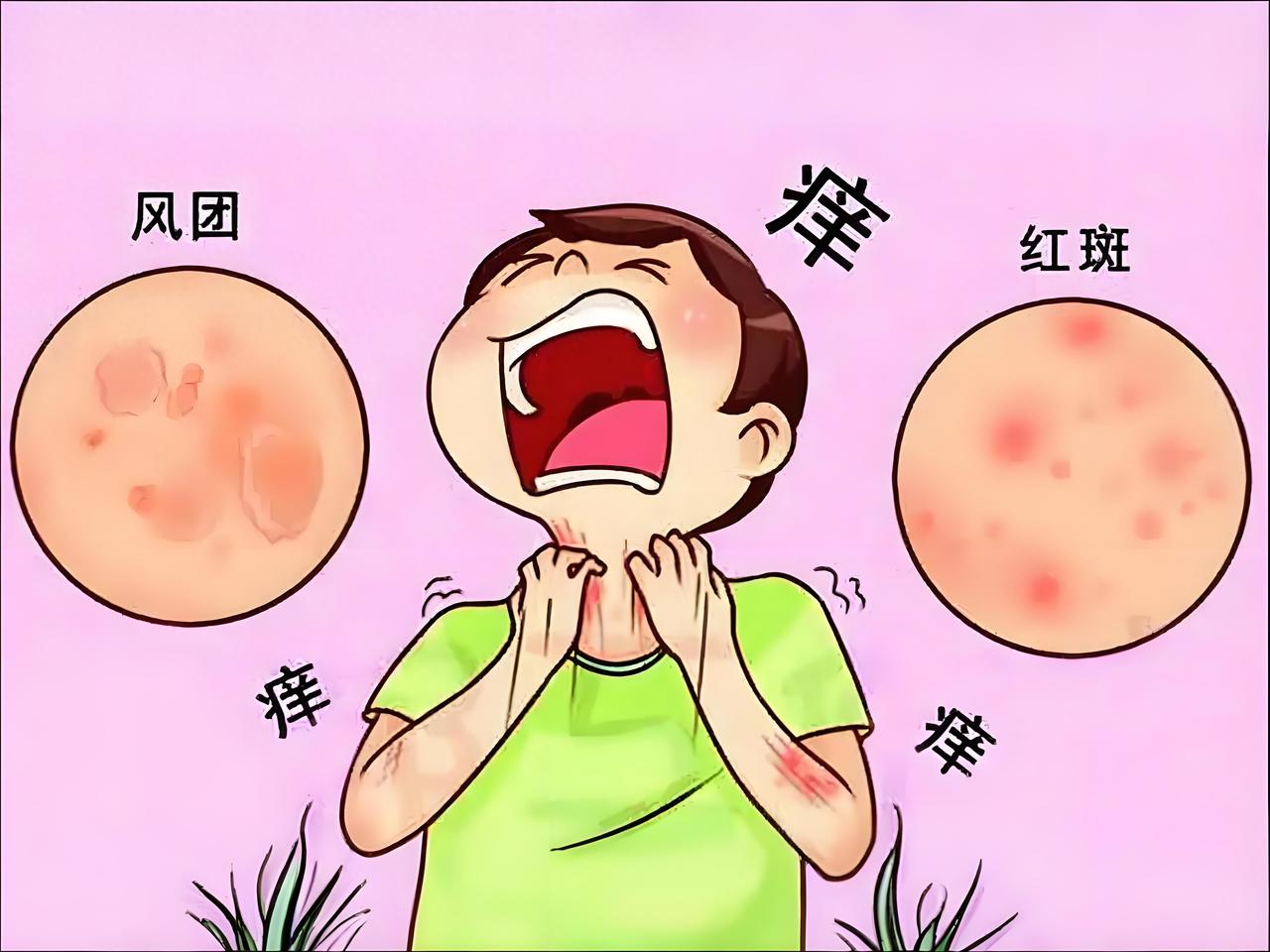 许多人不知道！荆防颗粒不只是治感冒，这几类问题用对也奇效作品声明：个人观点、仅