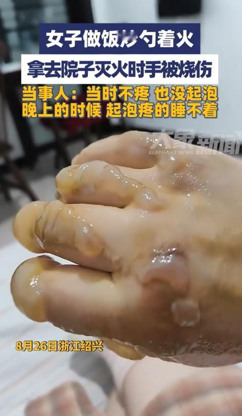 “悲剧还是发生了！”8月26日，浙江绍兴，一女子在家里做饭时，炒勺着火，女子没有
