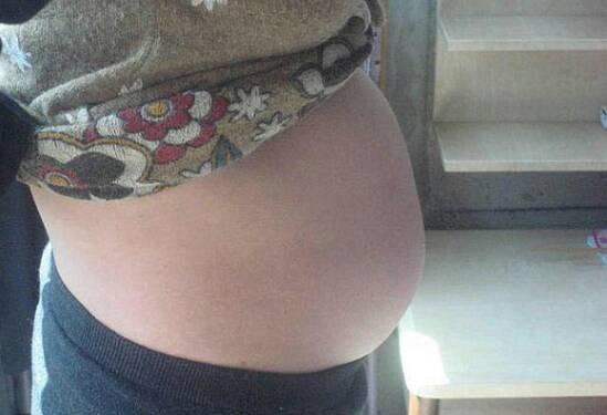 孕妇顺产生下男宝十天后, 以为“又怀孕了”医生检查后怒斥无知