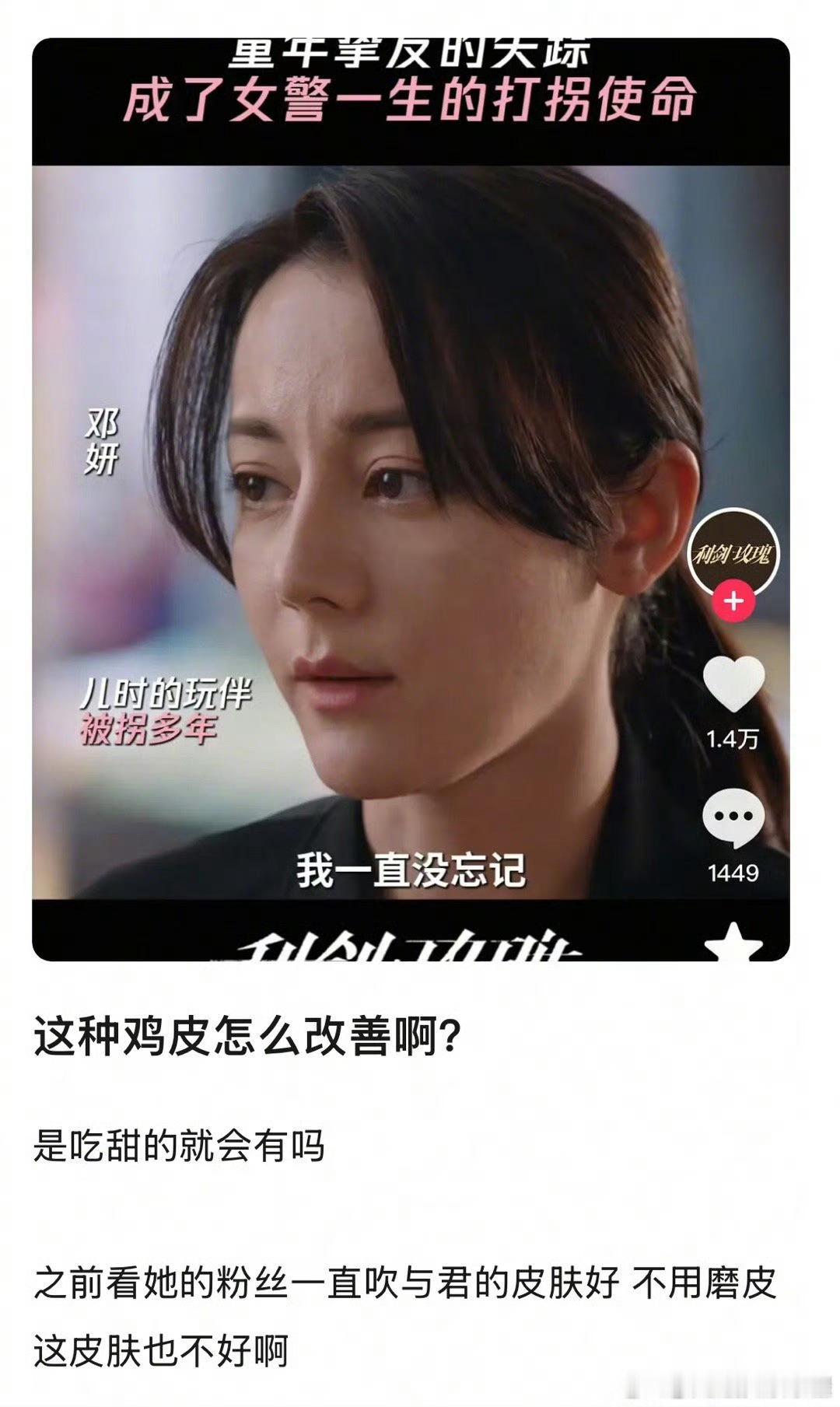 迪丽热巴皮肤是她的硬伤吗​​​