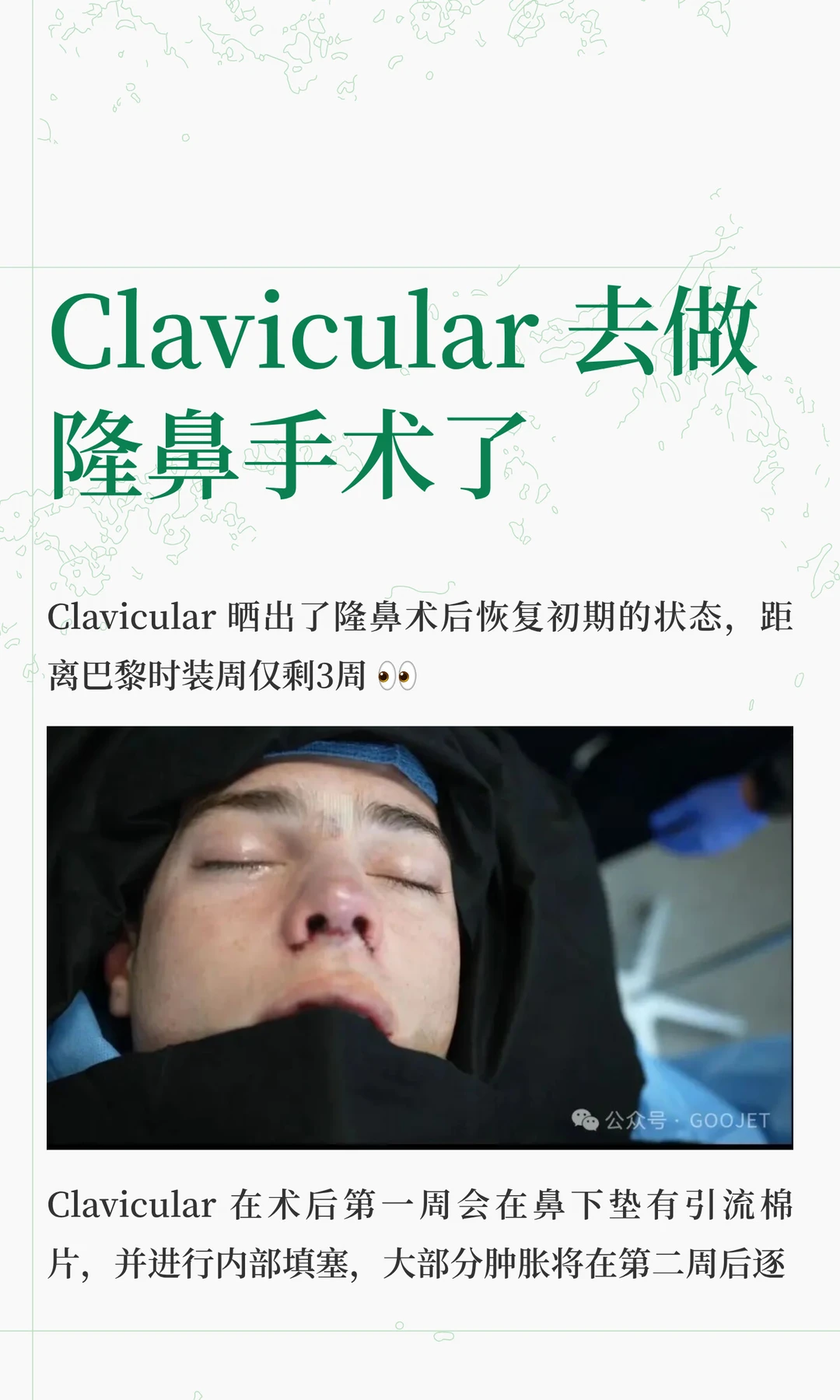 Clavicular 去做隆鼻手术了