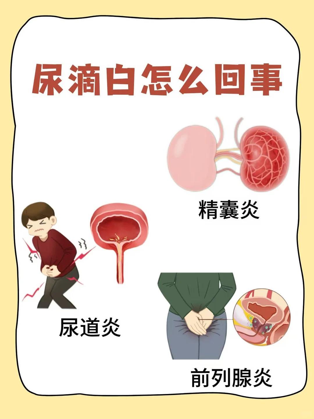 出现尿滴白不要慌，分清正常现象和异常信号