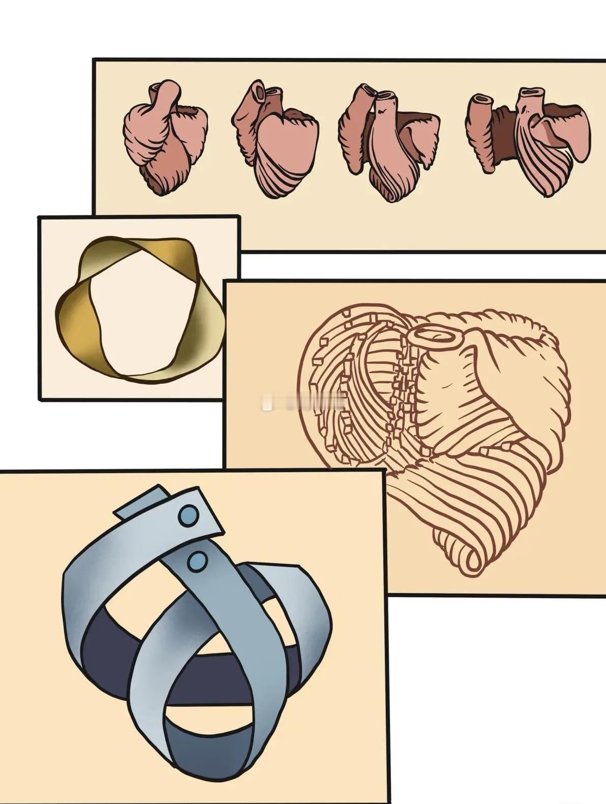 【心脏是一个“莫比乌斯环”】西班牙医生FranciscoTorrent-Gu