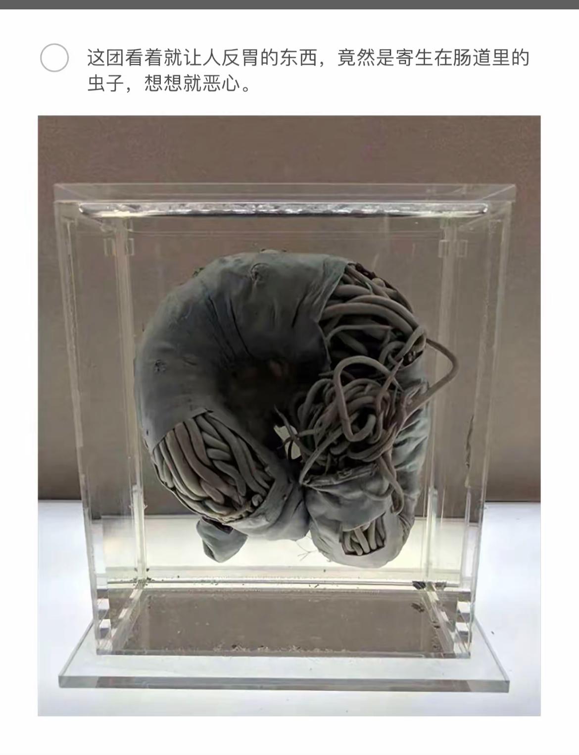 令人反胃的肠道寄生虫，细思极恐！