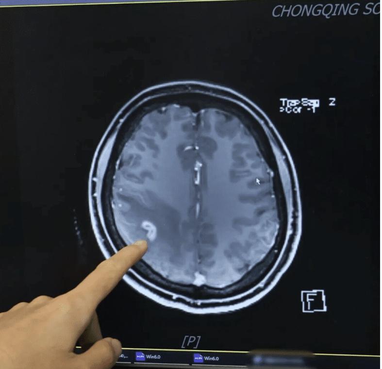近日，重庆沙坪坝发生了一件让人警醒的事，27岁的王女士因为长期身体不适，在重庆西
