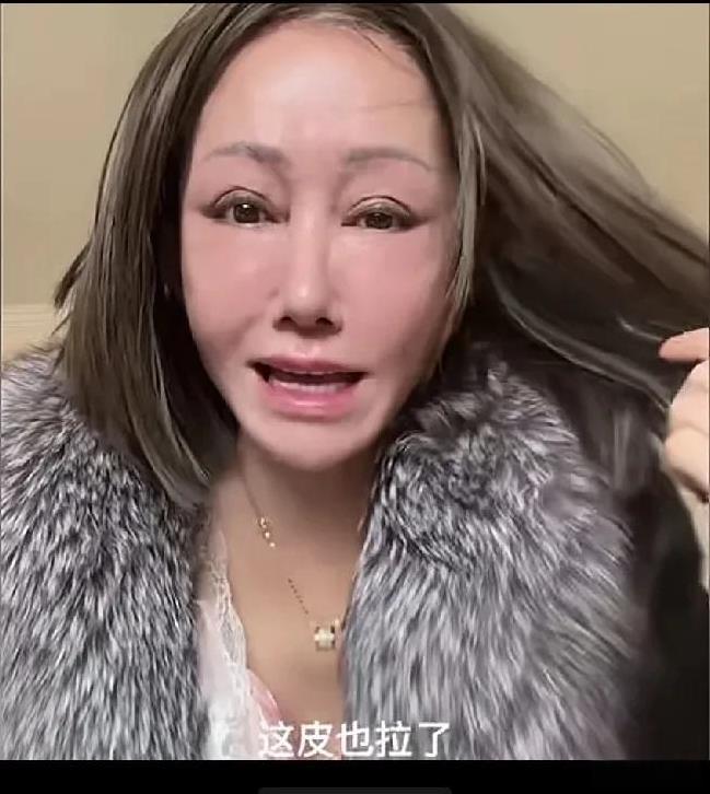 这位大姐皮也拉了而且拉了三次鼻子也做了眼袋也切了眉毛也切了双眼皮也拉