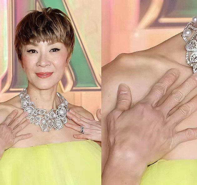 都知道杨紫琼脚趾外翻挺厉害，没想到她手指关节也有点粗。这位武打明星常年练武，身上