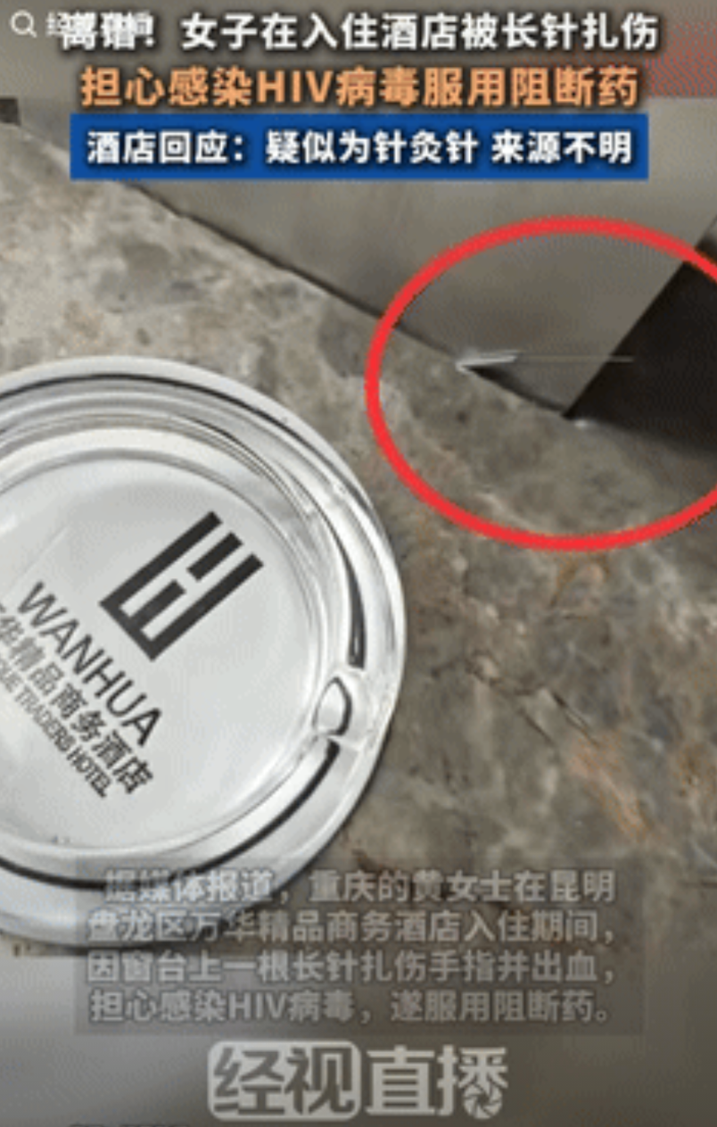 “这是真吓人！”重庆一女子入住昆明酒店，退房去拿窗台上的包包时，突然感到一阵疼痛