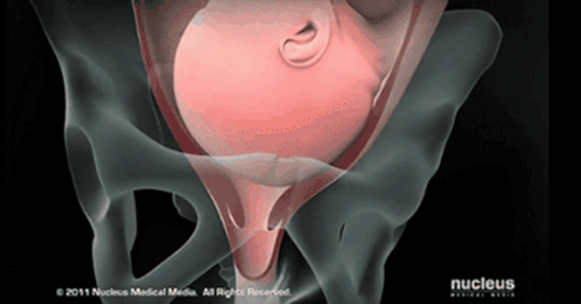 顺产好还是剖宫产好？看完这篇不再纠结每一个准妈妈，可能都曾困惑和摇摆过，到底是顺