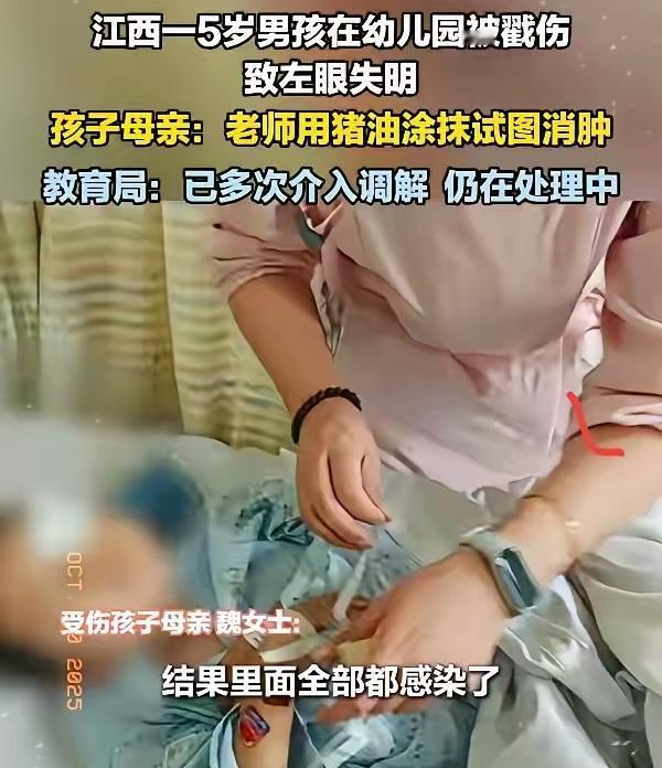 江西瑞昌某幼儿园里，一场本可避免的悲剧撕开了基层教育安全管理的裂痕。5岁男孩小宇
