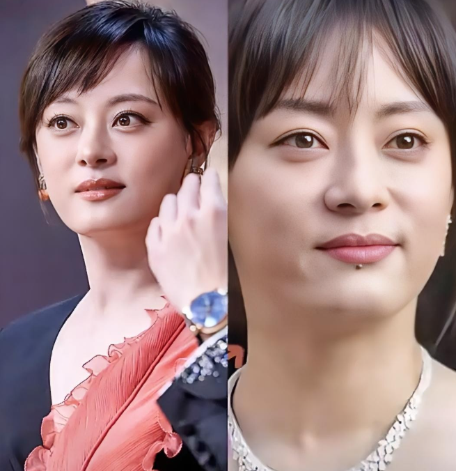 其实孙俪的下巴上的痣并不是天生的这个痣是在2003年一场车祸中留下的，是一个小