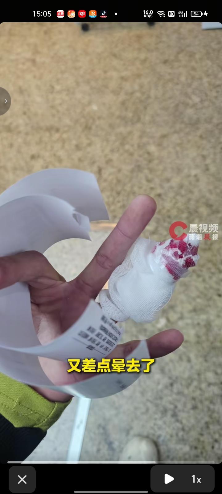 3月24日，浙江丽水。小伙切生姜时不慎切到手指，独自前往医院途中因晕血多次昏倒，