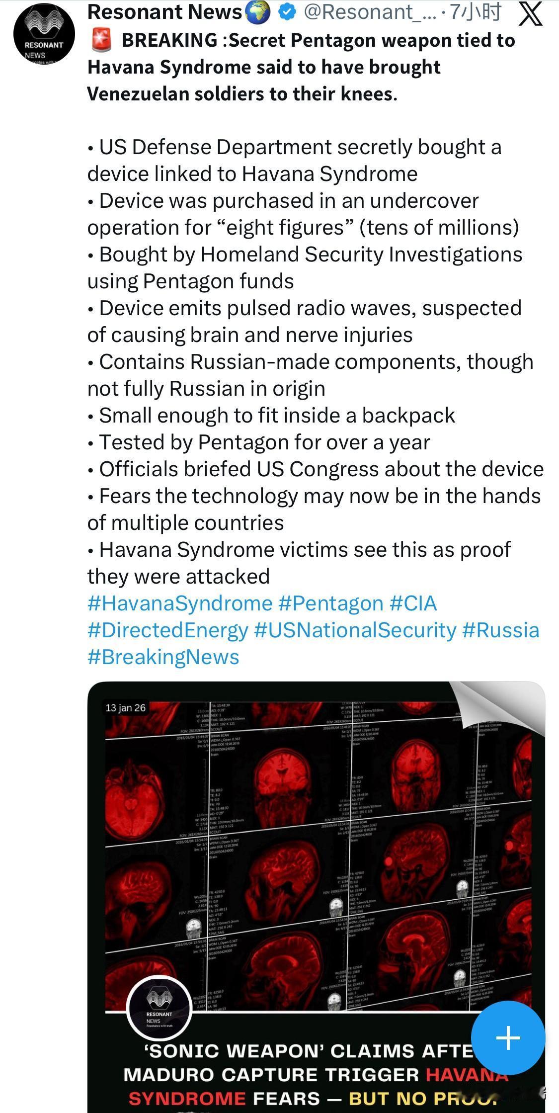 美国国防部秘密购买了一种与哈瓦那综合症有关的设备•该设备是在一次秘密行动中以