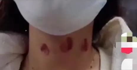 上海，女子吃药醒来后，发现脖子上有被吮吸出来的3个唇印，浑身像散架子一般酸痛无力