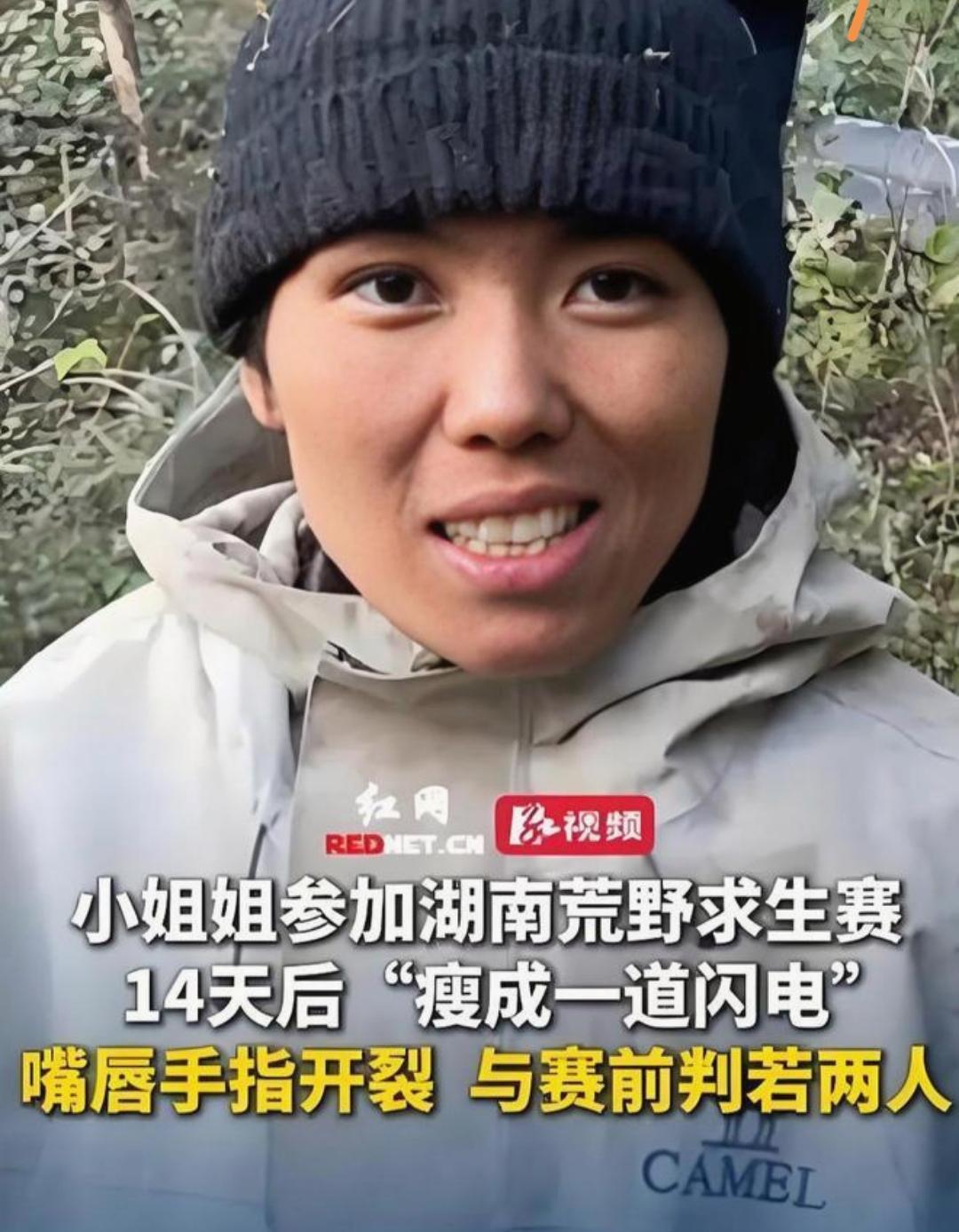 女子参加荒野求生14天后瘦成闪电，挑战极限生存考验引发热议。女子参加荒野求生1