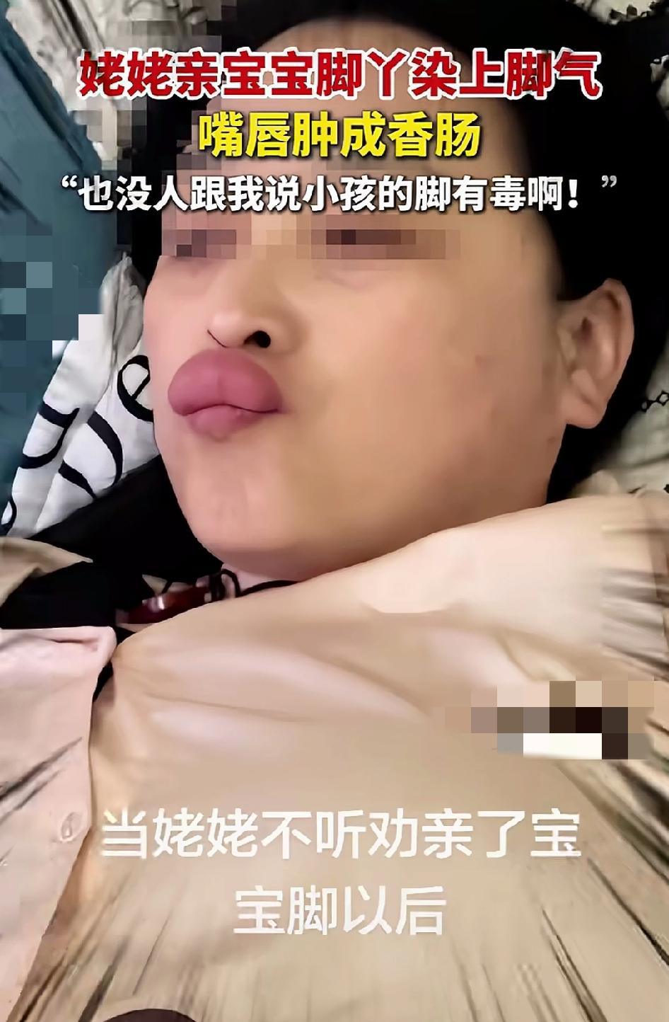 姥姥亲宝宝脚丫染上脚气，嘴唇肿成香肠，有点辛芷蕾的味道了，姥姥说没人说过小孩的