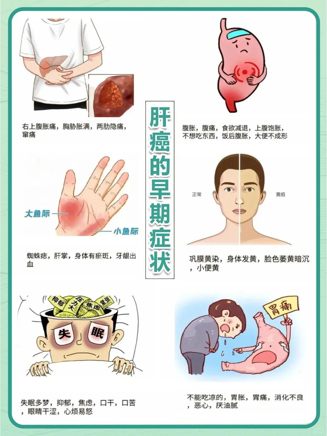 警惕！肝癌的第一个信号，根本不是肝疼！这3个症状才是关键，赶紧自查！ 你是不是