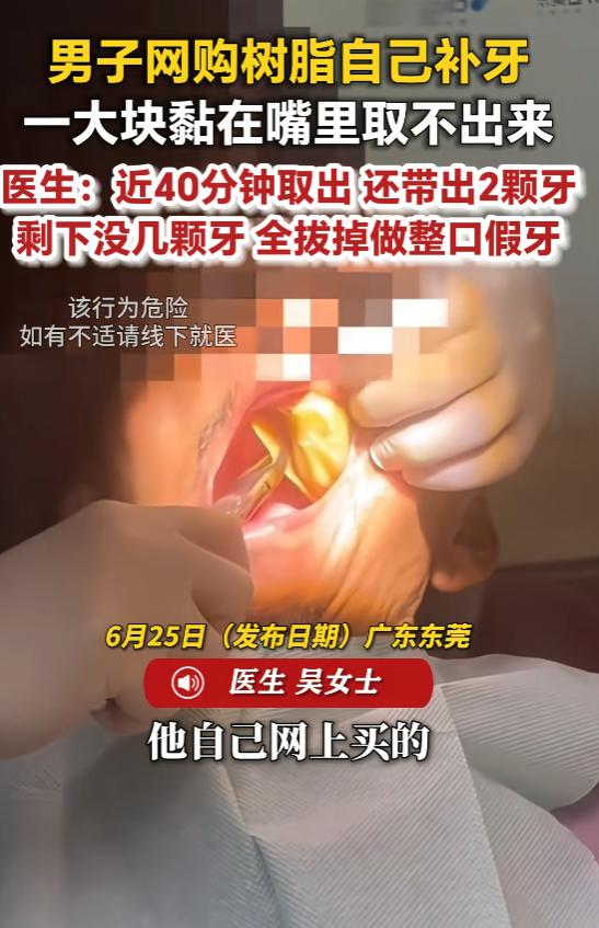 “得不偿失啊！”6月25日报道，广东东莞，一男子网购树脂补牙，没想到在操作过程