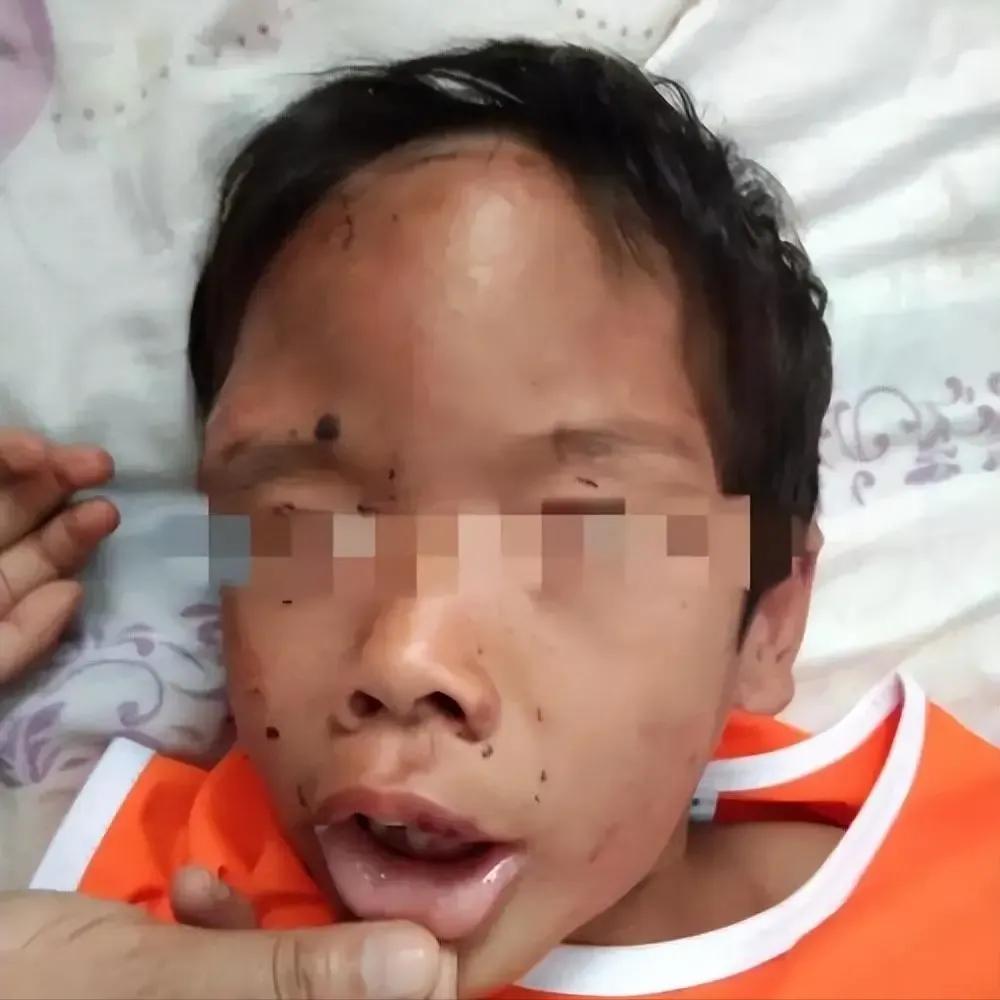 记住这个幼儿园，天水市麦积区培心幼儿园；记住这个幼儿园251名孩子233名铅中