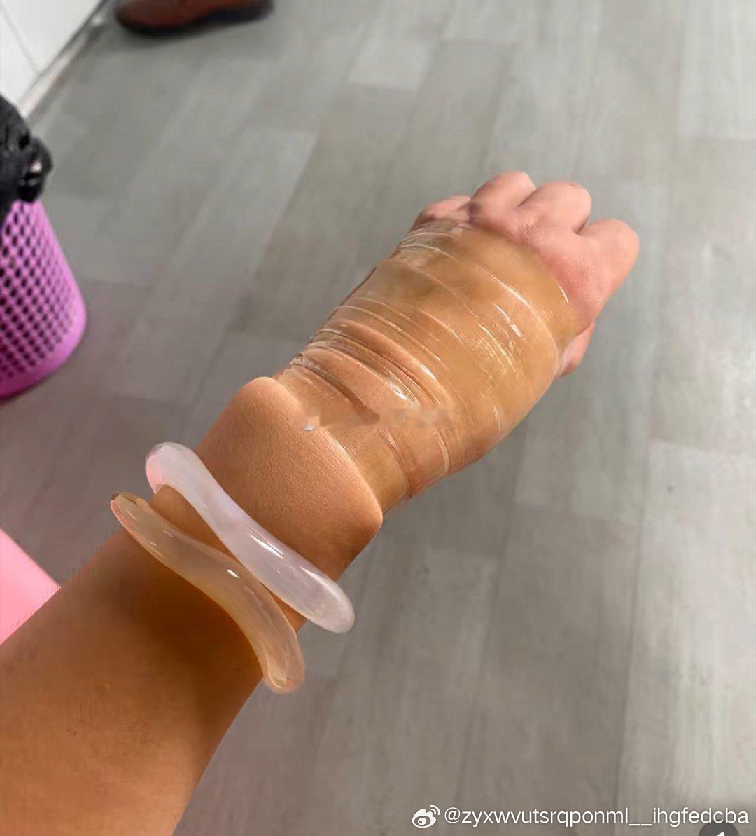 老妈的手镯取不下来了该咋办