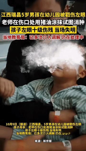 一夜醒来，父母的心都碎了！5岁儿子的眼睛被同学戳伤，老师一个动作直接导致其失