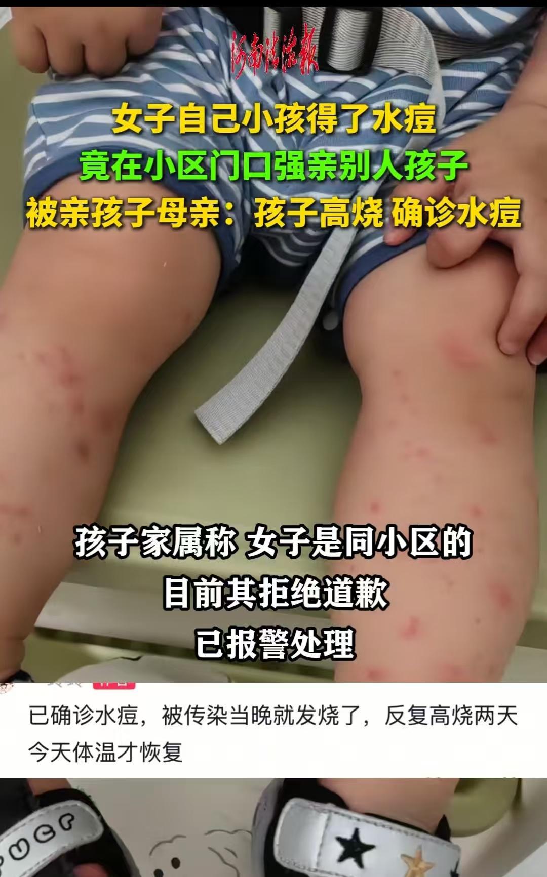 湖南，女子家的孩子出水痘，刚住院回来不到一星期，她就去亲别人家的小孩，导致别人家