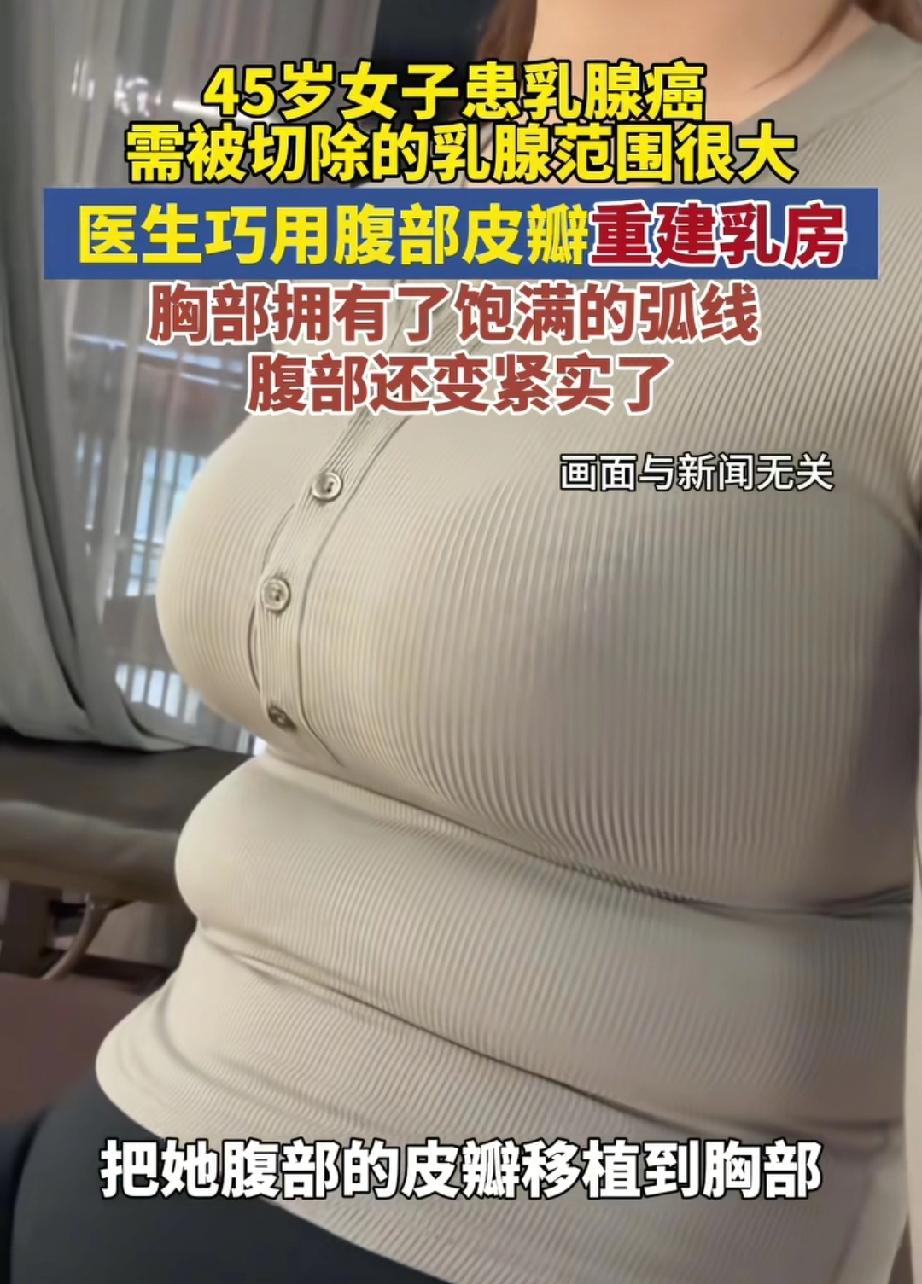 太厉害了！福建，一女子乳腺癌需要切除双乳担心无法面对未来生活，没成想她不仅成功切