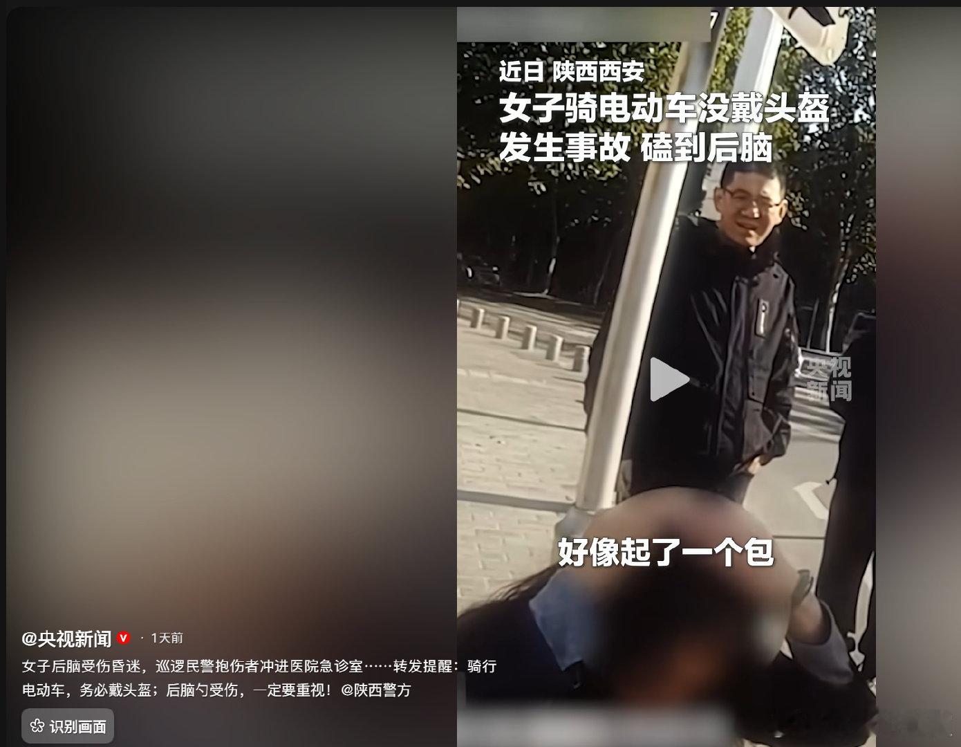 不戴头盔，女子磕到了后脑勺起包了，如果不是交警坚持带她去医院，估计就嗝屁了，因为上警车2分钟后就昏迷