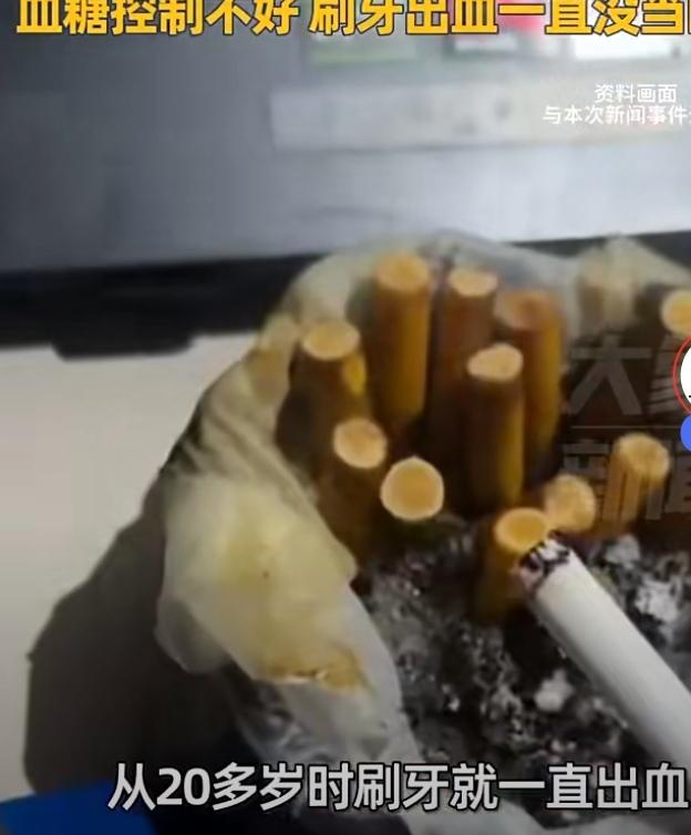 别让高血糖和烟草，毁掉你的牙齿近日一则新闻令人震惊不已。！40岁男子因