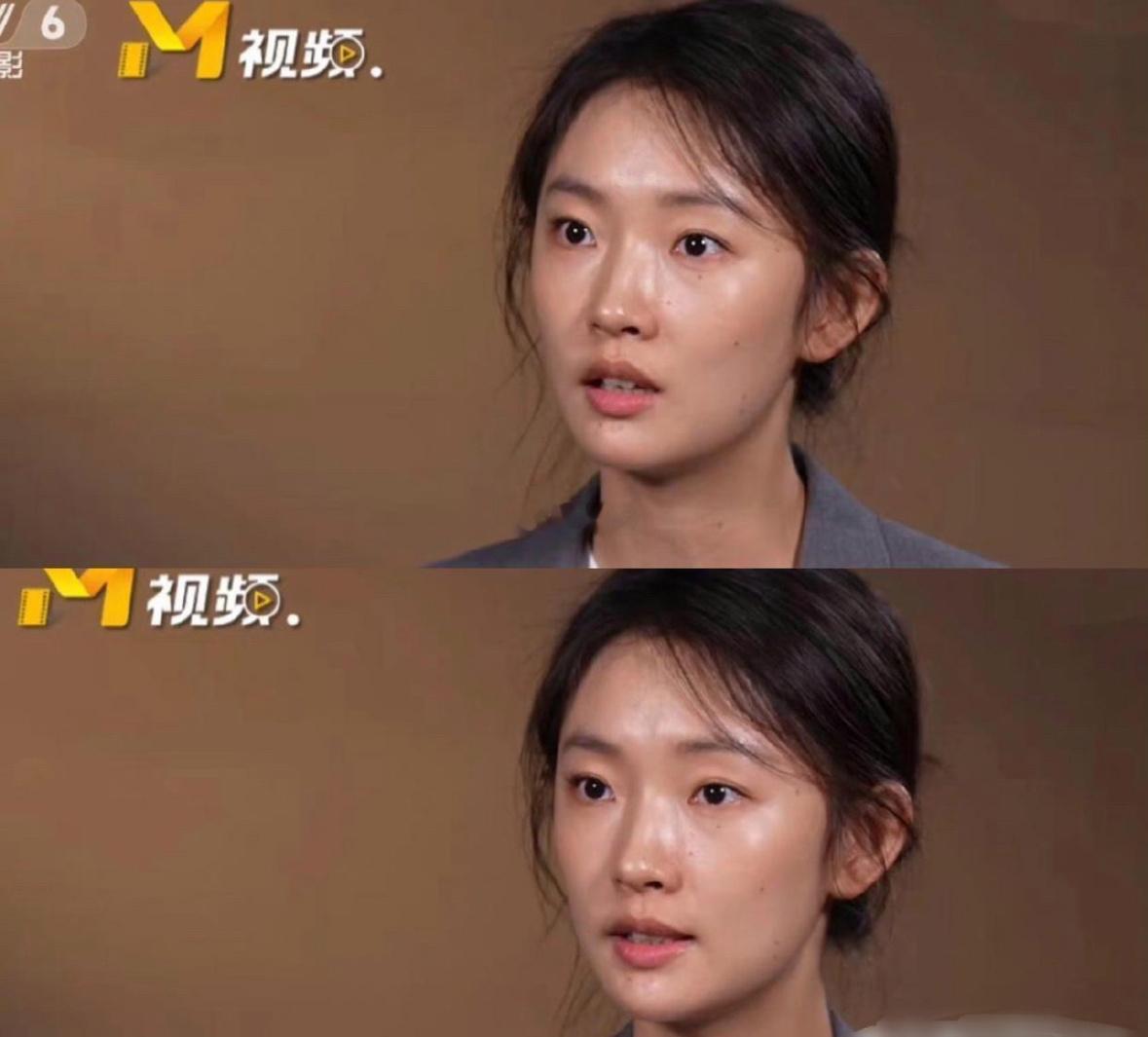 这才是老实的姑娘，人家说上央视得素颜，她就真的顶着个冒油光的大素脸去了…