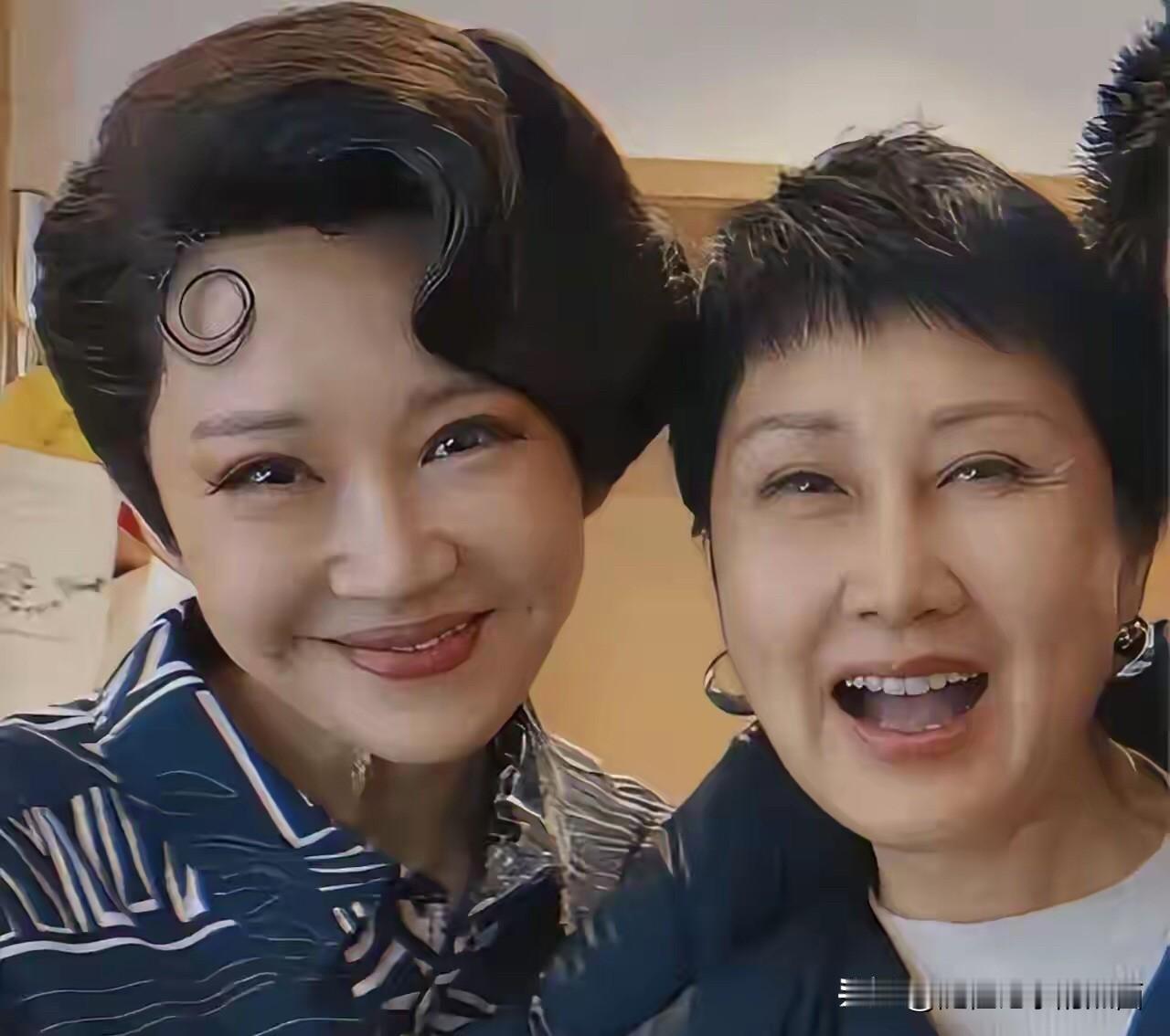 许晴年轻时候是多么漂亮的一个美女，怎么现在老了脸部僵硬，笑容不自然，看着都还没有