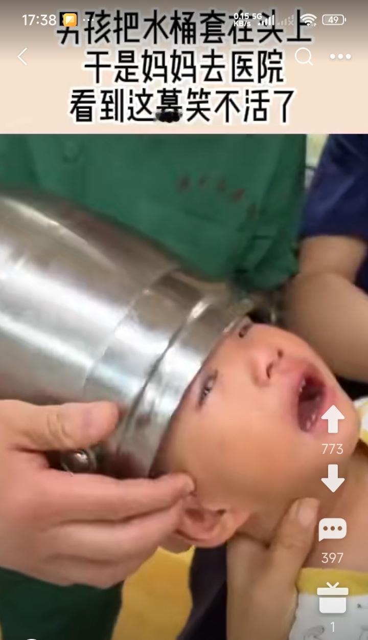熊孩子把水桶套在头上了，取不出来，孩子妈忙带孩子到医院看外科。网友说，孩子熊，