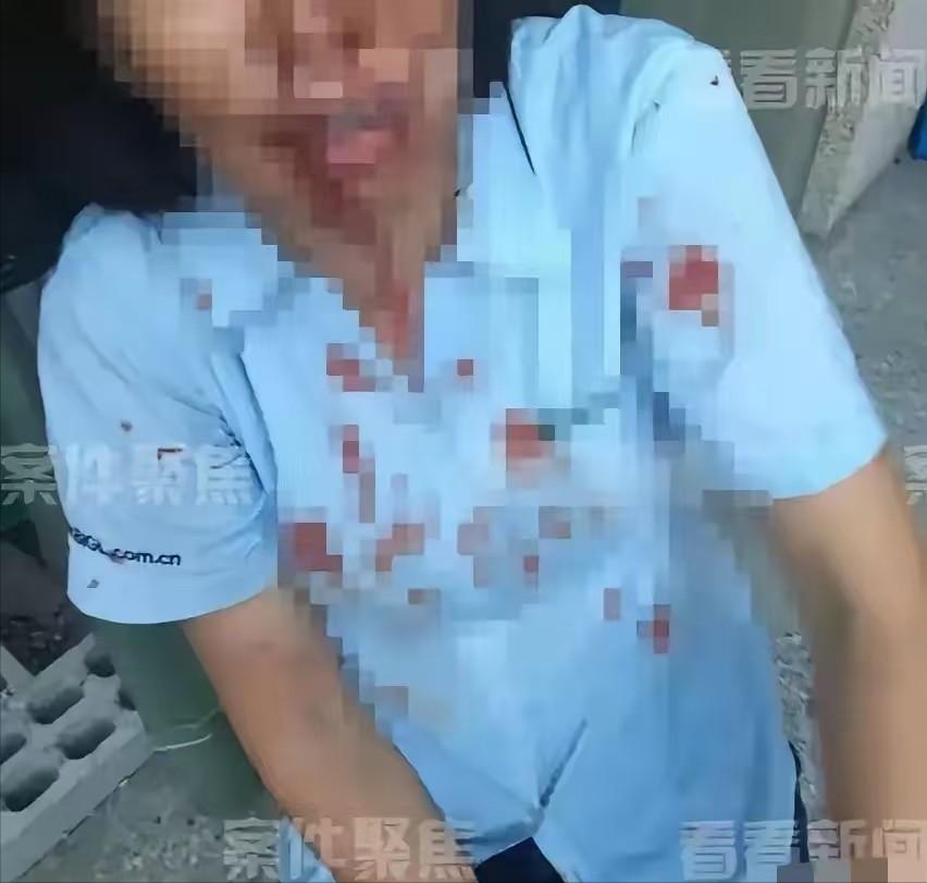 上海，一外甥带5人上门，对舅舅进行围殴，舅妈激愤之下，拿起一瓶强腐蚀性液体，直接