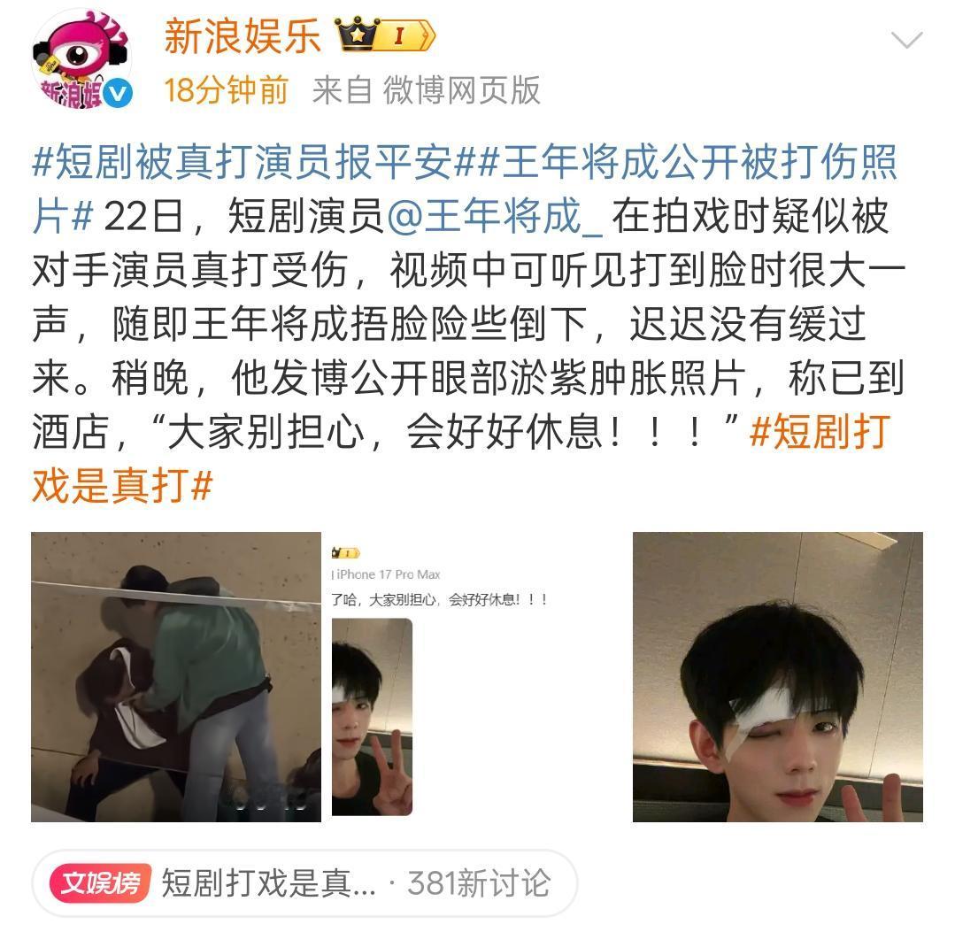 据新浪娱乐报道：22日，短剧演员王年将成_在拍戏时疑似被对手演员真打受伤，视频