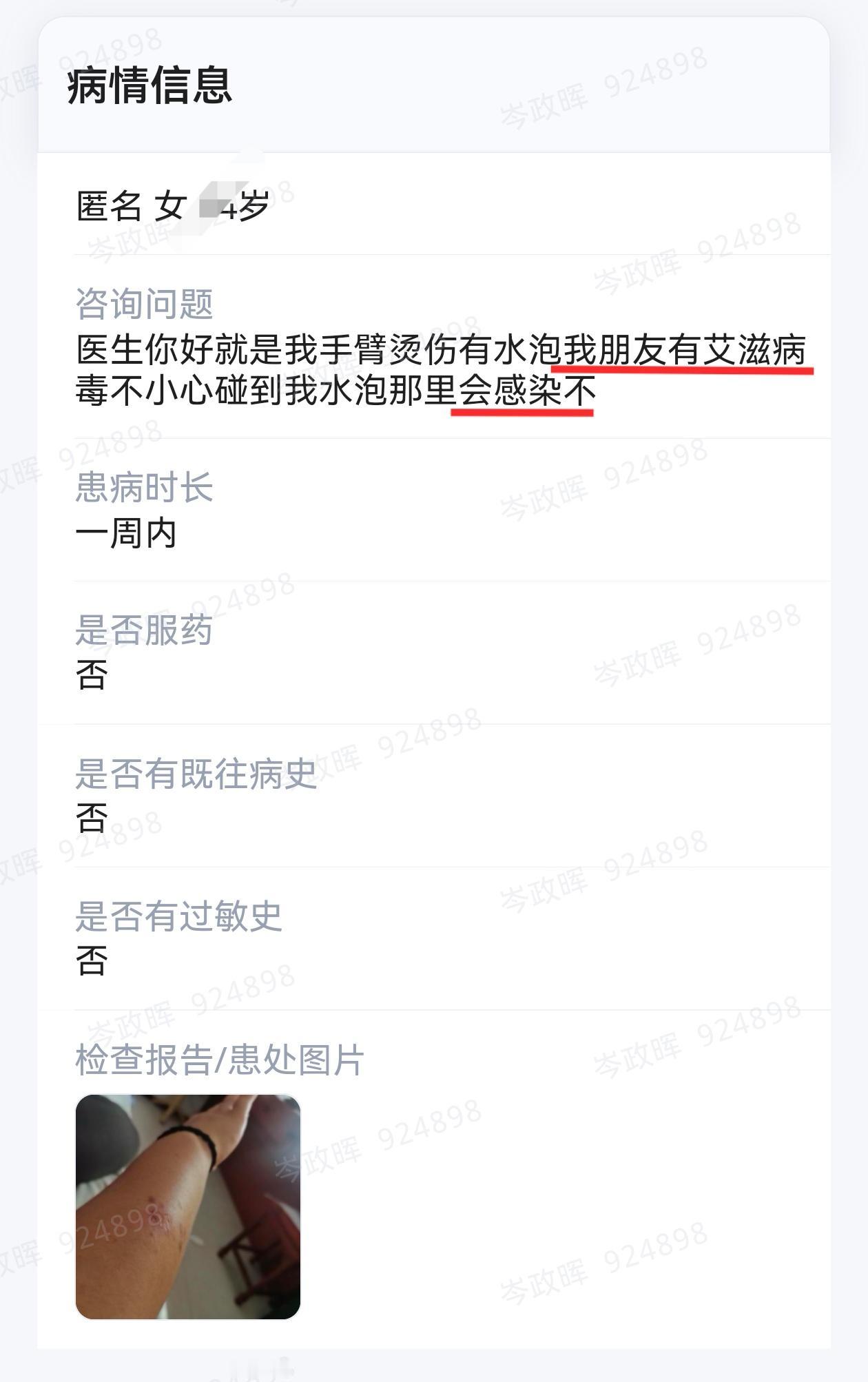 被艾滋病患者触摸伤口，会感染艾滋病吗？？一名年轻女性，说自己被患艾滋病的朋友