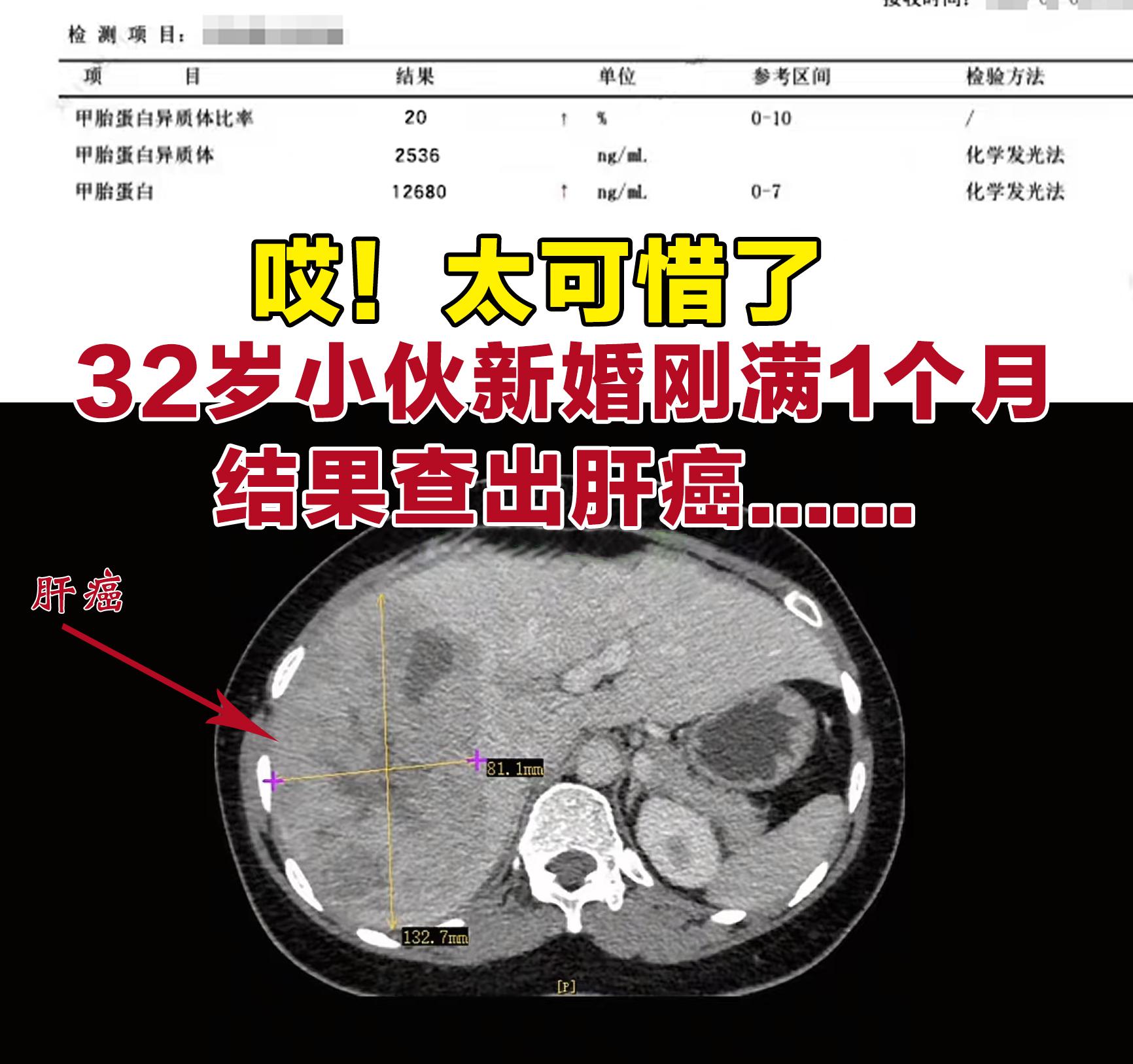 32岁的广西小伙子，新婚刚满一个月，本该沉浸在幸福里，却因体重1个月下...